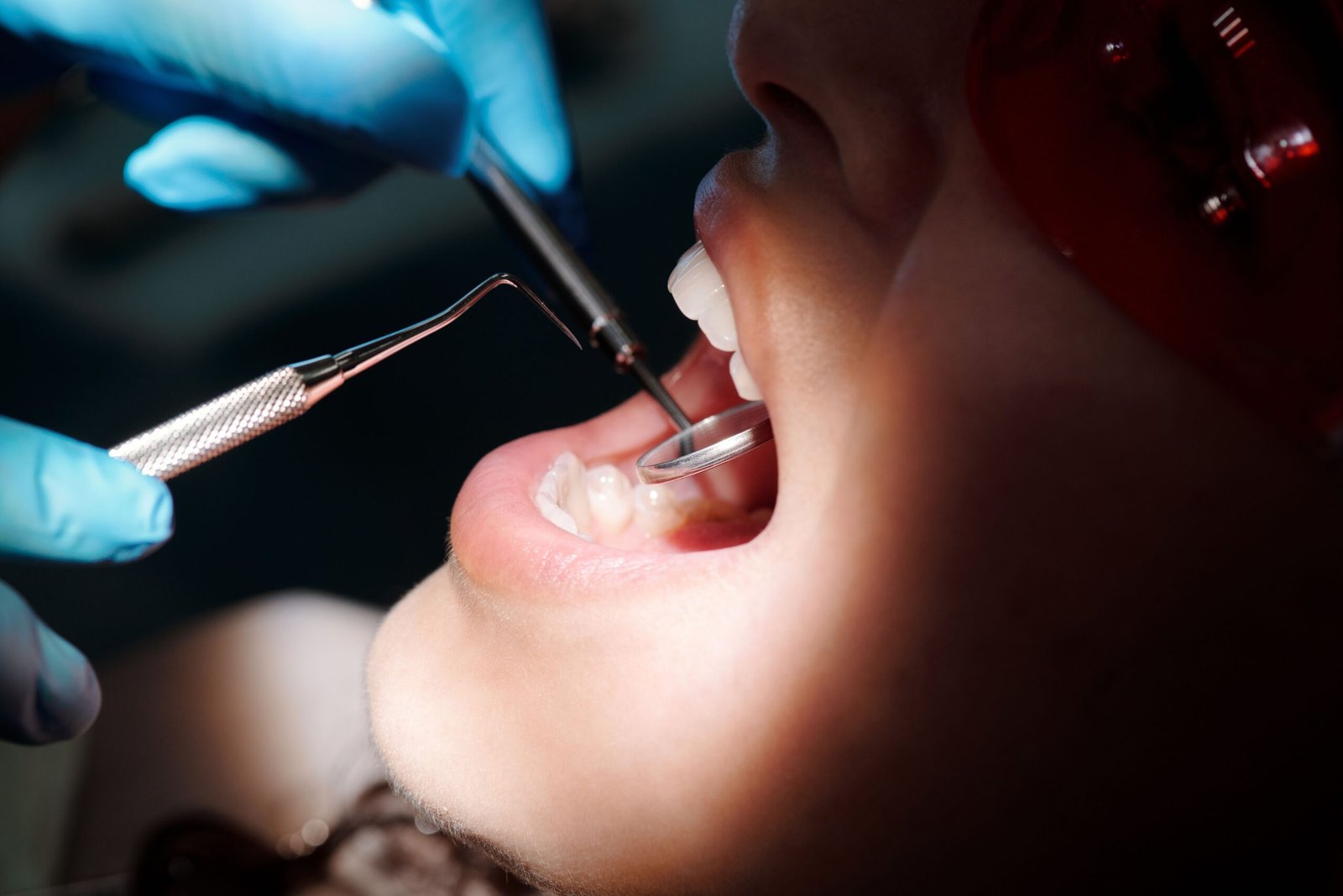Best Dental Cement for Crowns